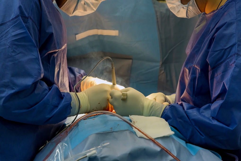 ANI M Doloris y su impacto en la analgesia postoperatoria en Panamá